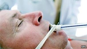 _51886626_intensivecarespl